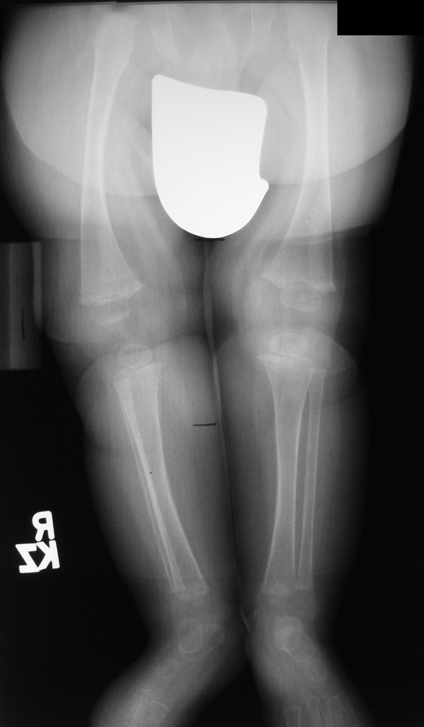 UCSD Musculoskeletal Radiology