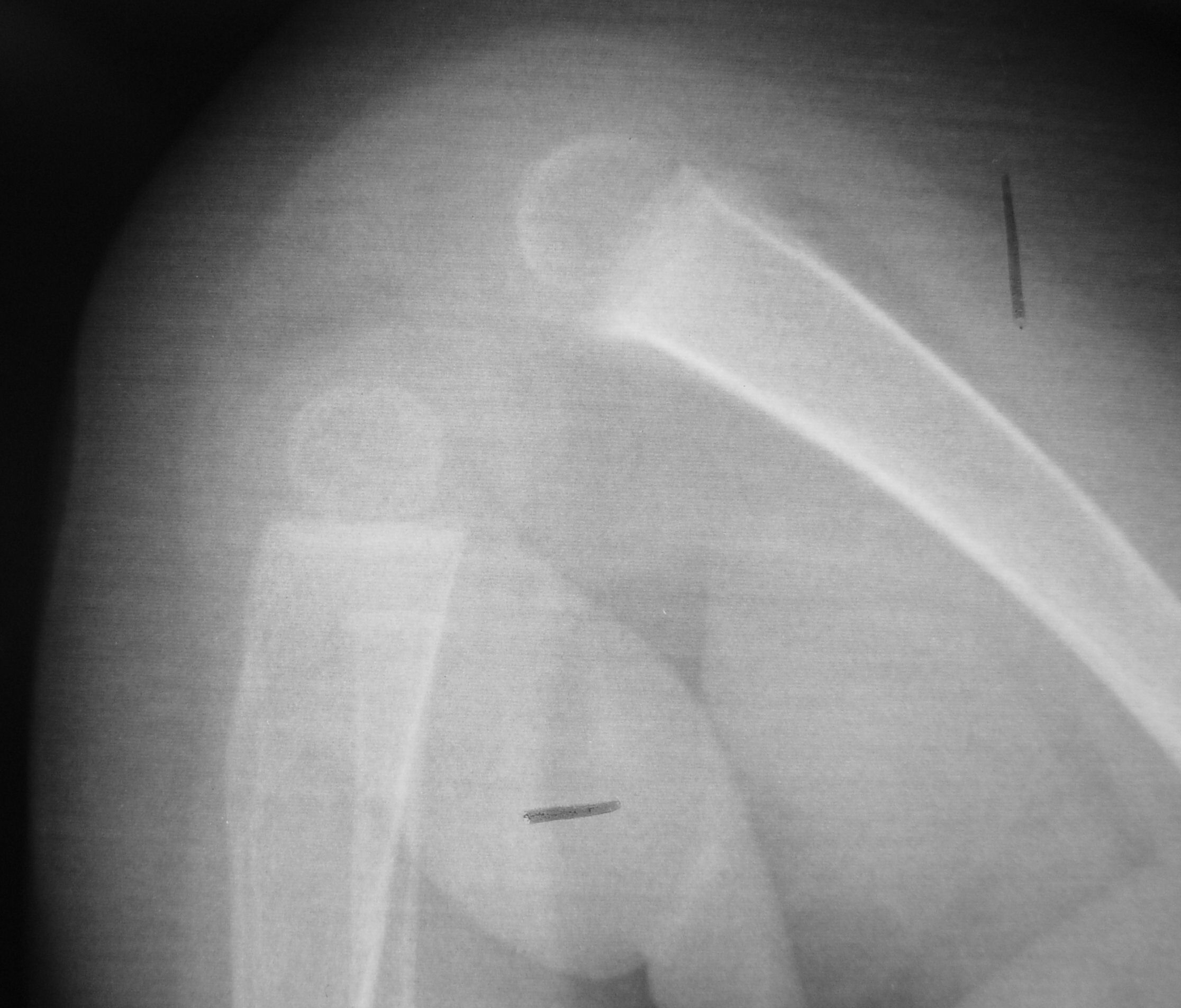 UCSD Musculoskeletal Radiology
